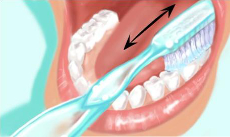 Technique de brossage des dents 1