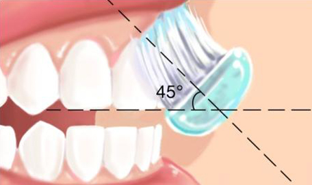 Technique de brossage des dents 2