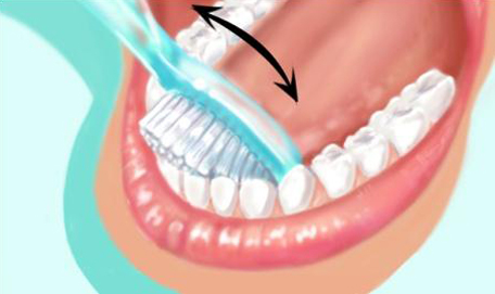 Technique de brossage des dents 6